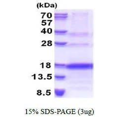 3 ?g of GTX67185-pro Human VEGF121 protein (active) by SDS-PAGE under reducing condition and visualized by coomassie blue stain