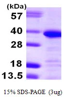 3microg Human Annexin A13 protein (GTX67223-pro) by SDS-PAGE under reducing condition and visualized by coomassie blue stain.
