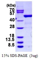 3microg Human ARHGDIB protein (GTX67235-pro) by SDS-PAGE under reducing condition and visualized by coomassie blue stain. 3microg Human ARHGDIB protein (GTX67235-pro) by SDS-PAGE under reducing condition and visualized by coomassie blue stain.