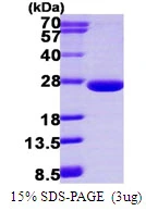 3microg Human ARL3 protein (GTX67237-pro) by SDS-PAGE under reducing condition and visualized by coomassie blue stain. 3microg Human ARL3 protein (GTX67237-pro) by SDS-PAGE under reducing condition and visualized by coomassie blue stain.