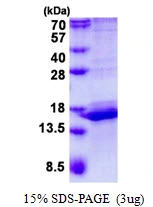 3microg Human CALML3 protein (GTX67263-pro) by SDS-PAGE under reducing condition and visualized by coomassie blue stain.