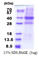 3?g Human CAPZA2 protein (GTX67267-pro) by SDS-PAGE under reducing condition and visualized by coomassie blue stain.