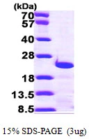 3microg Human Centrin3 protein (GTX67293-pro) by SDS-PAGE under reducing condition and visualized by coomassie blue stain.