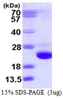 3microg Human Cofilin 2 protein (GTX67295-pro) by SDS-PAGE under reducing condition and visualized by coomassie blue stain.