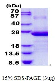 3microg Human AP3S1 protein (GTX67303-pro) by SDS-PAGE under reducing condition and visualized by coomassie blue stain.