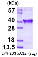 3microg Human CLTA protein (GTX67308-pro) by SDS-PAGE under reducing condition and visualized by coomassie blue stain.