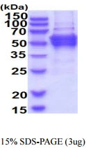3microg Human DPH2 protein (GTX67359-pro) by SDS-PAGE under reducing condition and visualized by coomassie blue stain.