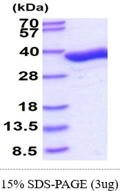 3?g Human GPD1 protein (GTX67428-pro) by SDS-PAGE under reducing condition and visualized by coomassie blue stain.
