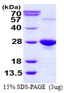 3?g Human GPX1 protein (GTX67431-pro) by SDS-PAGE under reducing condition and visualized by coomassie blue stain.