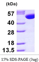 3microg Human GSS protein (GTX67436-pro) by SDS-PAGE under reducing condition and visualized by coomassie blue stain.