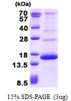 3microg Human Hemoglobin gamma 2 protein (GTX67454-pro) by SDS-PAGE under reducing condition and visualized by coomassie blue stain.