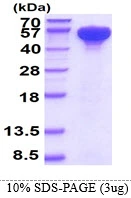 3microg Human Hsp70 protein (GTX67483-pro) by SDS-PAGE under reducing condition and visualized by coomassie blue stain.