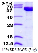 3microg Human IMPDH2 protein (GTX67502-pro) by SDS-PAGE under reducing condition and visualized by coomassie blue stain.