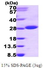 3?g Human ITPase protein (GTX67506-pro) by SDS-PAGE under reducing condition and visualized by coomassie blue stain.