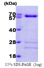 3microg Human SMAD4 protein (GTX67531-pro) by SDS-PAGE under reducing condition and visualized by coomassie blue stain. 3microg Human SMAD4 protein (GTX67531-pro) by SDS-PAGE under reducing condition and visualized by coomassie blue stain.