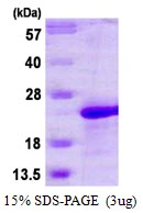3microg Human MAFG protein (GTX67532-pro) by SDS-PAGE under reducing condition and visualized by coomassie blue stain. 3microg Human MAFG protein (GTX67532-pro) by SDS-PAGE under reducing condition and visualized by coomassie blue stain.