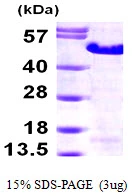 3microg Human MAGEA3 protein (GTX67533-pro) by SDS-PAGE under reducing condition and visualized by coomassie blue stain. 3microg Human MAGEA3 protein (GTX67533-pro) by SDS-PAGE under reducing condition and visualized by coomassie blue stain.