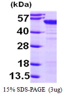 3microg Human MAGEA4 protein (GTX67534-pro) by SDS-PAGE under reducing condition and visualized by coomassie blue stain. 3microg Human MAGEA4 protein (GTX67534-pro) by SDS-PAGE under reducing condition and visualized by coomassie blue stain.
