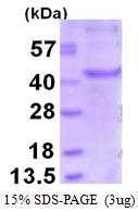 3microg Human MAGEA6 protein (GTX67536-pro) by SDS-PAGE under reducing condition and visualized by coomassie blue stain. 3microg Human MAGEA6 protein (GTX67536-pro) by SDS-PAGE under reducing condition and visualized by coomassie blue stain.