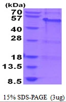 3microg Human MAGEA8 protein (GTX67537-pro) by SDS-PAGE under reducing condition and visualized by coomassie blue stain. 3microg Human MAGEA8 protein (GTX67537-pro) by SDS-PAGE under reducing condition and visualized by coomassie blue stain.
