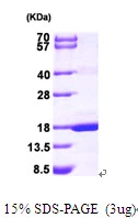 3microg Human MAGOH protein (GTX67538-pro) by SDS-PAGE under reducing condition and visualized by coomassie blue stain. 3microg Human MAGOH protein (GTX67538-pro) by SDS-PAGE under reducing condition and visualized by coomassie blue stain.