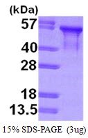 3microg Human Tau protein (GTX67539-pro) by SDS-PAGE under reducing condition and visualized by coomassie blue stain. 3microg Human Tau protein (GTX67539-pro) by SDS-PAGE under reducing condition and visualized by coomassie blue stain.