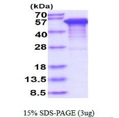 3microg Human Tau protein (GTX67541-pro) by SDS-PAGE under reducing condition and visualized by coomassie blue stain. 3microg Human Tau protein (GTX67541-pro) by SDS-PAGE under reducing condition and visualized by coomassie blue stain.