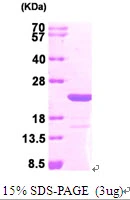 3microg Human MAX protein (GTX67545-pro) by SDS-PAGE under reducing condition and visualized by coomassie blue stain. 3microg Human MAX protein (GTX67545-pro) by SDS-PAGE under reducing condition and visualized by coomassie blue stain.