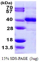 3microg Human MPG protein (GTX67559-pro) by SDS-PAGE under reducing condition and visualized by coomassie blue stain.