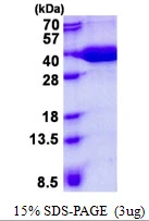 3microg Human MPST protein (GTX67561-pro) by SDS-PAGE under reducing condition and visualized by coomassie blue stain. 3microg Human MPST protein (GTX67561-pro) by SDS-PAGE under reducing condition and visualized by coomassie blue stain.