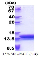 3microg Human MTCP1 protein (GTX67563-pro) by SDS-PAGE under reducing condition and visualized by coomassie blue stain. 3microg Human MTCP1 protein (GTX67563-pro) by SDS-PAGE under reducing condition and visualized by coomassie blue stain.