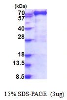 3microg Human MX1 protein (GTX67567-pro) by SDS-PAGE under reducing condition and visualized by coomassie blue stain. 3microg Human MX1 protein (GTX67567-pro) by SDS-PAGE under reducing condition and visualized by coomassie blue stain.