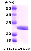 3microg Human Myosin Light Chain 2 (MLC-2v) protein (GTX67569-pro) by SDS-PAGE under reducing condition and visualized by coomassie blue stain. 3microg Human Myosin Light Chain 2 (MLC-2v) protein (GTX67569-pro) by SDS-PAGE under reducing condition and visualized by coomassie blue stain.