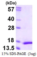 3microg Human MYL5 protein (GTX67571-pro) by SDS-PAGE under reducing condition and visualized by coomassie blue stain. 3microg Human MYL5 protein (GTX67571-pro) by SDS-PAGE under reducing condition and visualized by coomassie blue stain.