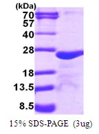 3microg Human MYL5 protein (GTX67572-pro) by SDS-PAGE under reducing condition and visualized by coomassie blue stain. 3microg Human MYL5 protein (GTX67572-pro) by SDS-PAGE under reducing condition and visualized by coomassie blue stain.