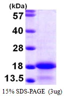 3microg Human MYL6 protein (GTX67573-pro) by SDS-PAGE under reducing condition and visualized by coomassie blue stain. 3microg Human MYL6 protein (GTX67573-pro) by SDS-PAGE under reducing condition and visualized by coomassie blue stain.