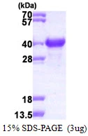 3microg Human NACA1 protein (GTX67574-pro) by SDS-PAGE under reducing condition and visualized by coomassie blue stain. 3microg Human NACA1 protein (GTX67574-pro) by SDS-PAGE under reducing condition and visualized by coomassie blue stain.