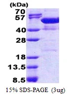 3microg Human NAP1L4 protein (GTX67575-pro) by SDS-PAGE under reducing condition and visualized by coomassie blue stain.