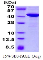 3microg Human NCF4 protein (GTX67578-pro) by SDS-PAGE under reducing condition and visualized by coomassie blue stain. 3microg Human NCF4 protein (GTX67578-pro) by SDS-PAGE under reducing condition and visualized by coomassie blue stain.