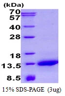 3microg Human NDUFA2 protein (GTX67580-pro) by SDS-PAGE under reducing condition and visualized by coomassie blue stain. 3microg Human NDUFA2 protein (GTX67580-pro) by SDS-PAGE under reducing condition and visualized by coomassie blue stain.