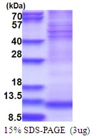 3microg Human NDUFA4 protein (GTX67581-pro) by SDS-PAGE under reducing condition and visualized by coomassie blue stain. 3microg Human NDUFA4 protein (GTX67581-pro) by SDS-PAGE under reducing condition and visualized by coomassie blue stain.