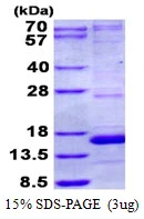 3microg Human NDUFA5 protein (GTX67582-pro) by SDS-PAGE under reducing condition and visualized by coomassie blue stain. 3microg Human NDUFA5 protein (GTX67582-pro) by SDS-PAGE under reducing condition and visualized by coomassie blue stain.