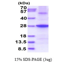 3microg Human NDUFB9 protein (GTX67583-pro) by SDS-PAGE under reducing condition and visualized by coomassie blue stain. 3microg Human NDUFB9 protein (GTX67583-pro) by SDS-PAGE under reducing condition and visualized by coomassie blue stain.