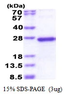 3microg Human NDUFS5 protein (GTX67584-pro) by SDS-PAGE under reducing condition and visualized by coomassie blue stain. 3microg Human NDUFS5 protein (GTX67584-pro) by SDS-PAGE under reducing condition and visualized by coomassie blue stain.