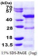3microg Human DRG1 protein (GTX67585-pro) by SDS-PAGE under reducing condition and visualized by coomassie blue stain. 3microg Human DRG1 protein (GTX67585-pro) by SDS-PAGE under reducing condition and visualized by coomassie blue stain.