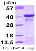 3microg Human IKB alpha protein (GTX67588-pro) by SDS-PAGE under reducing condition and visualized by coomassie blue stain. 3microg Human IKB alpha protein (GTX67588-pro) by SDS-PAGE under reducing condition and visualized by coomassie blue stain.