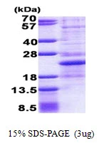3microg Human NHLH1 protein (GTX67590-pro) by SDS-PAGE under reducing condition and visualized by coomassie blue stain. 3microg Human NHLH1 protein (GTX67590-pro) by SDS-PAGE under reducing condition and visualized by coomassie blue stain.