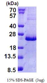 3microg Human NHLH2 protein (GTX67591-pro) by SDS-PAGE under reducing condition and visualized by coomassie blue stain. 3microg Human NHLH2 protein (GTX67591-pro) by SDS-PAGE under reducing condition and visualized by coomassie blue stain.