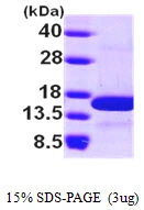3microg Human NHP2L1 protein (GTX67592-pro) by SDS-PAGE under reducing condition and visualized by coomassie blue stain. 3microg Human NHP2L1 protein (GTX67592-pro) by SDS-PAGE under reducing condition and visualized by coomassie blue stain.