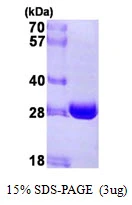 3microg Human NQO2 protein (GTX67596-pro) by SDS-PAGE under reducing condition and visualized by coomassie blue stain. 3microg Human NQO2 protein (GTX67596-pro) by SDS-PAGE under reducing condition and visualized by coomassie blue stain.